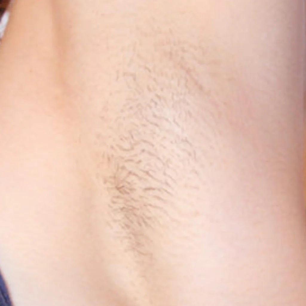 Native Beauty™ - Cyperus Rotundus Oil